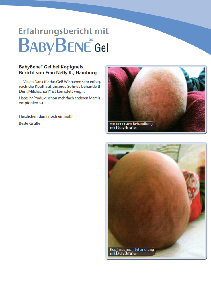 Testimonianze BabyBene Gel
